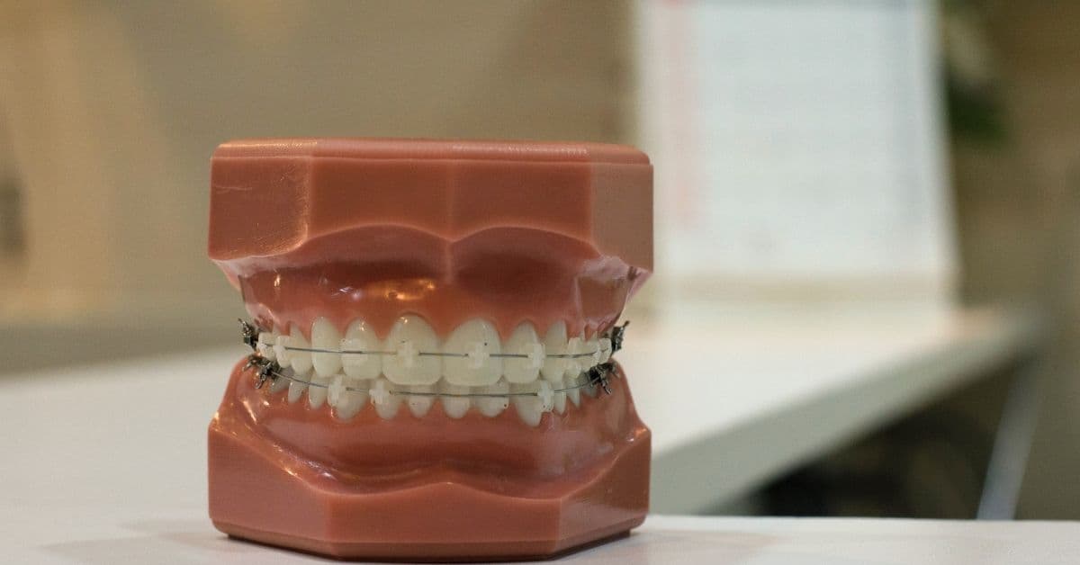 Classical Orthodontics