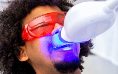 Professional teeth whitening