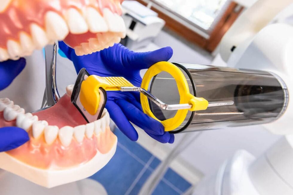 Radiografie con tecnica Bite Wings Mauro Savio