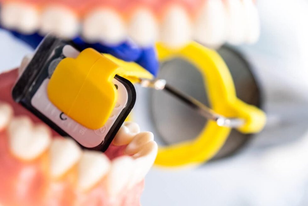 Radiografie con tecnica Bite Wings Mauro Savio