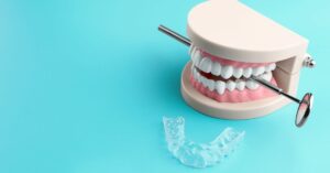 Bruxism: what is it, what causes it, and how to treat it?