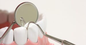 Parodontite: se un familiare ne soffre il rischio aumenta?