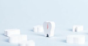 Переломы зубов: как их распознать?