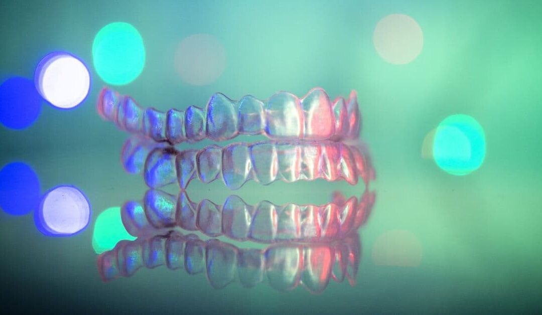 Mascherine di contenzione (retainer) dopo il trattamento ortodontico: a cosa servono?