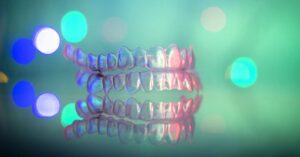 Ретейнеры после ортодонтического лечения: для чего они нужны?