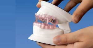 Обструктивное апноэ сна и роль стоматолога в диагностике и лечении