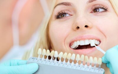 Aesthetic dental veneers